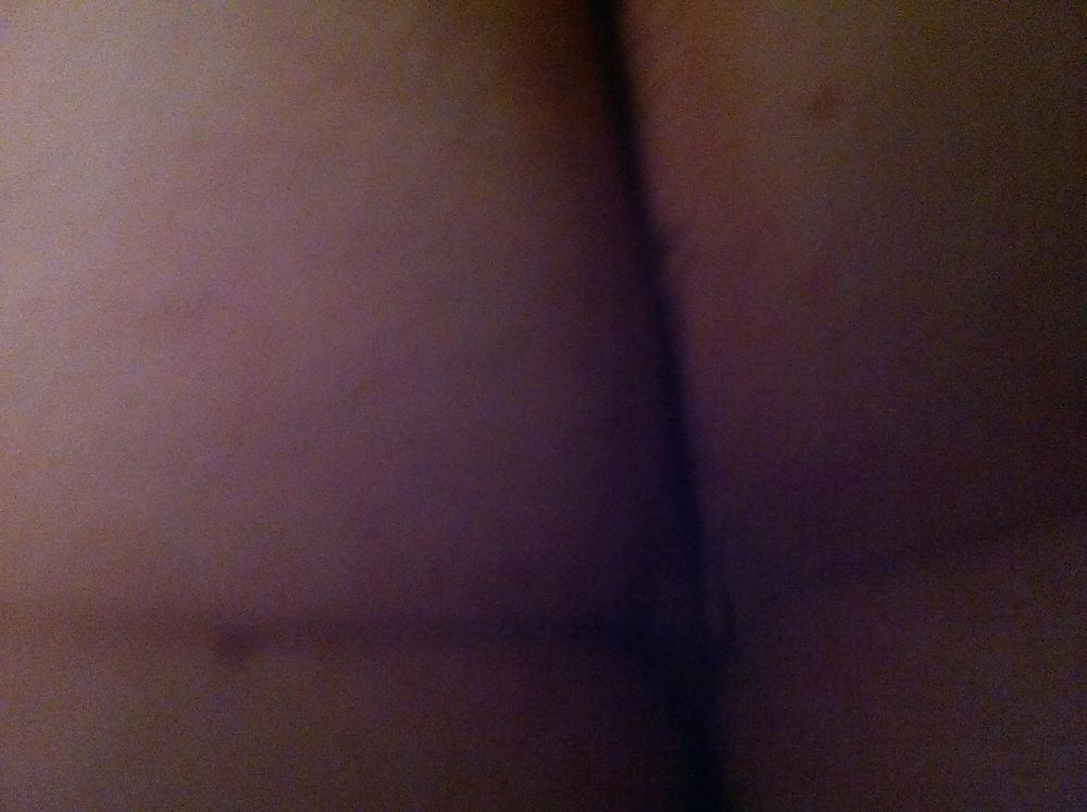 7P 18 y.o pre anal