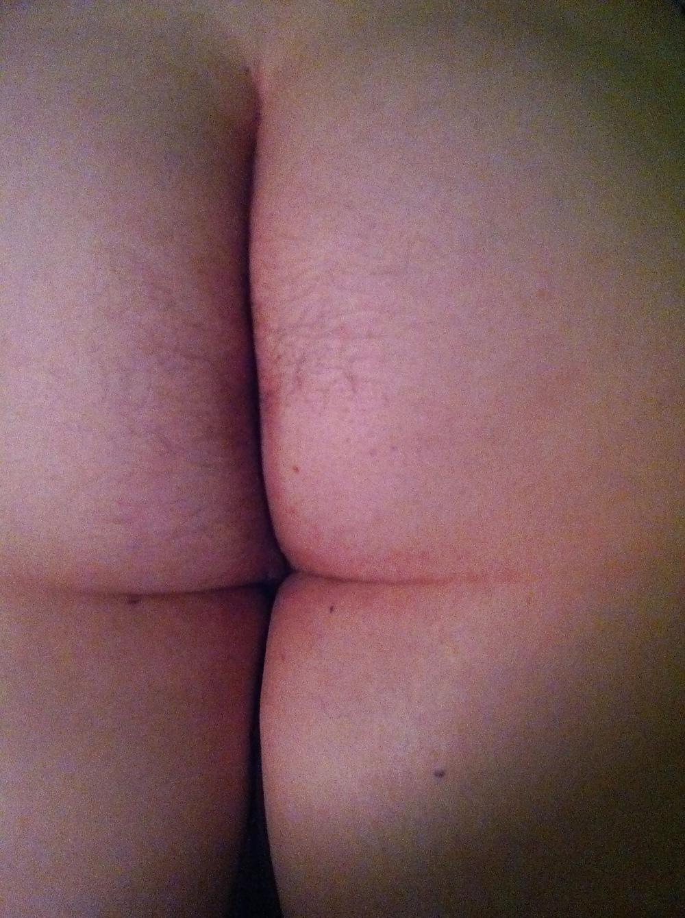 7P 18 y.o pre anal
