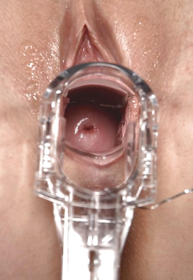 25P Pussy Deep Space