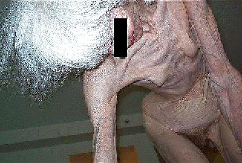 24P EXTREMELY SKINNY AND VERY OLD HAIRY GRANNY