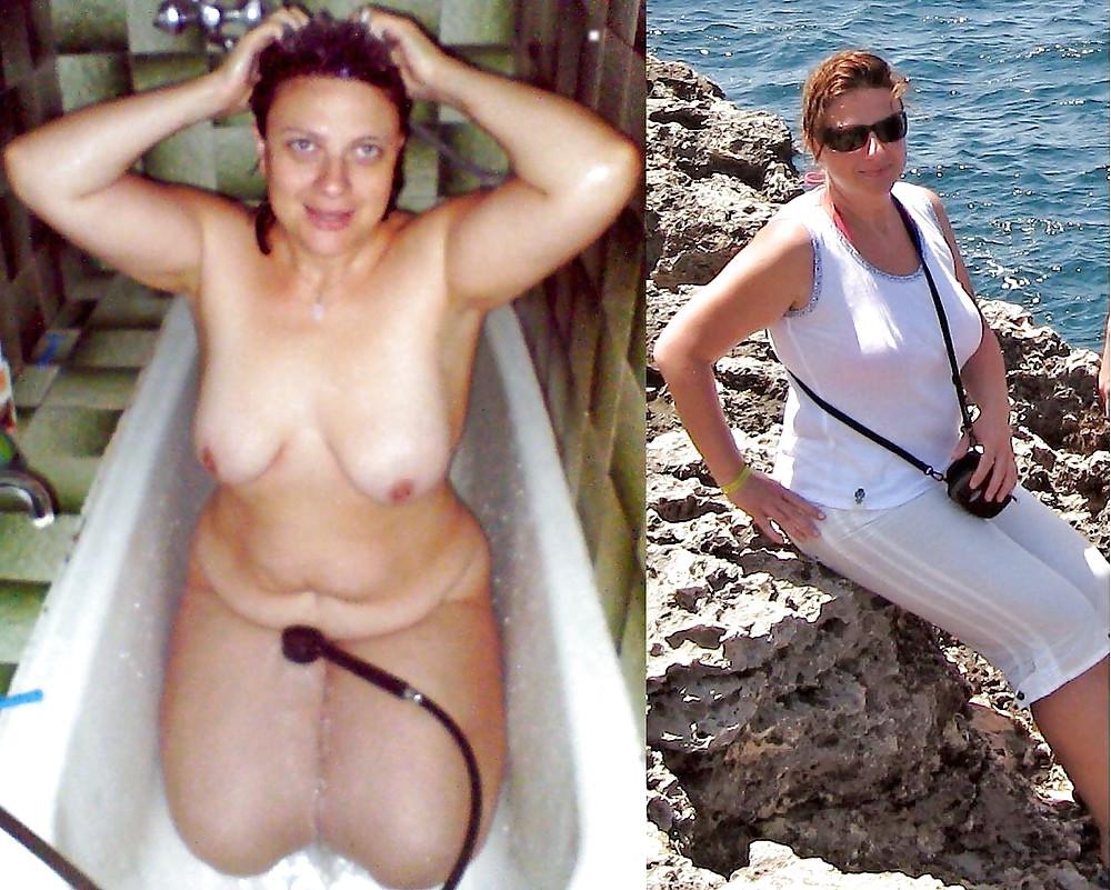 25P CLOTHED & UNCLOTHED