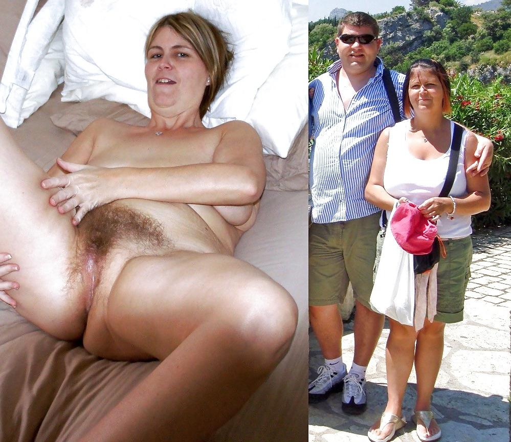 25P CLOTHED & UNCLOTHED