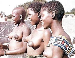 25P Brustwarzen mit grossen Warzenhof Puffy Nipples 