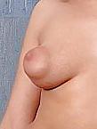 25P Brustwarzen mit grossen Warzenhof Puffy Nipples 