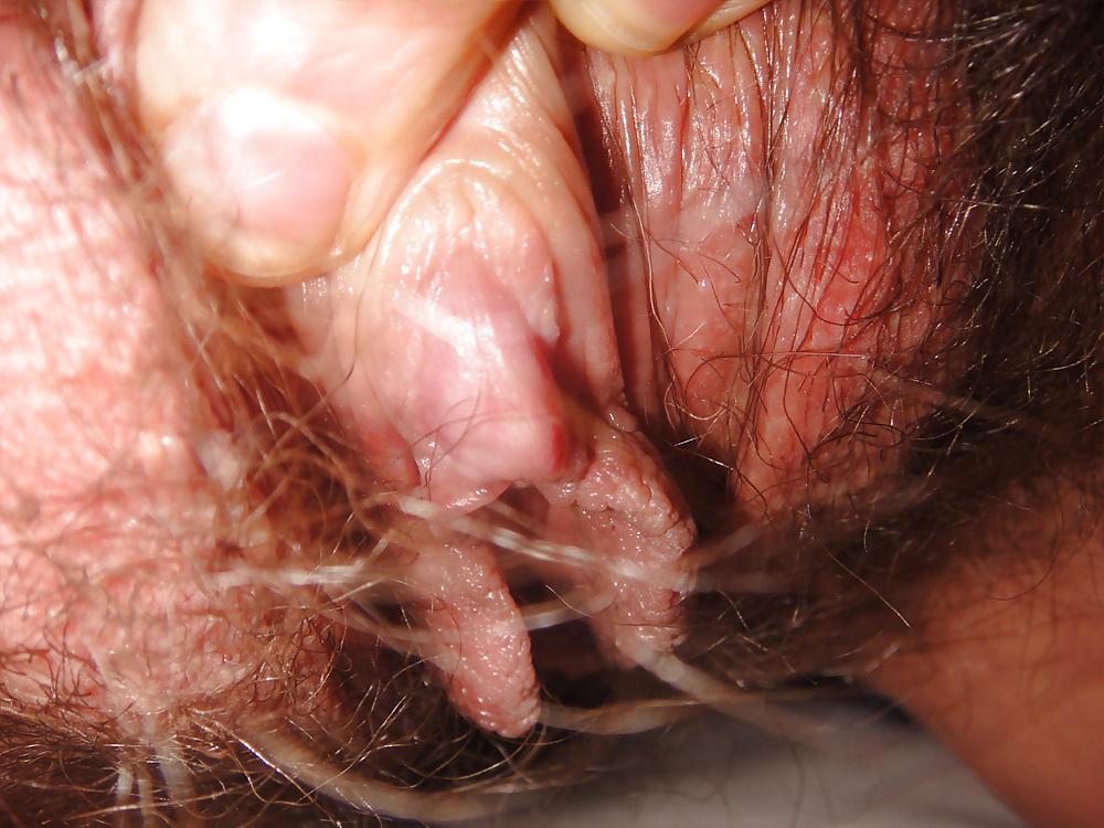 14P Huge close-ups of my clit and hairy lips