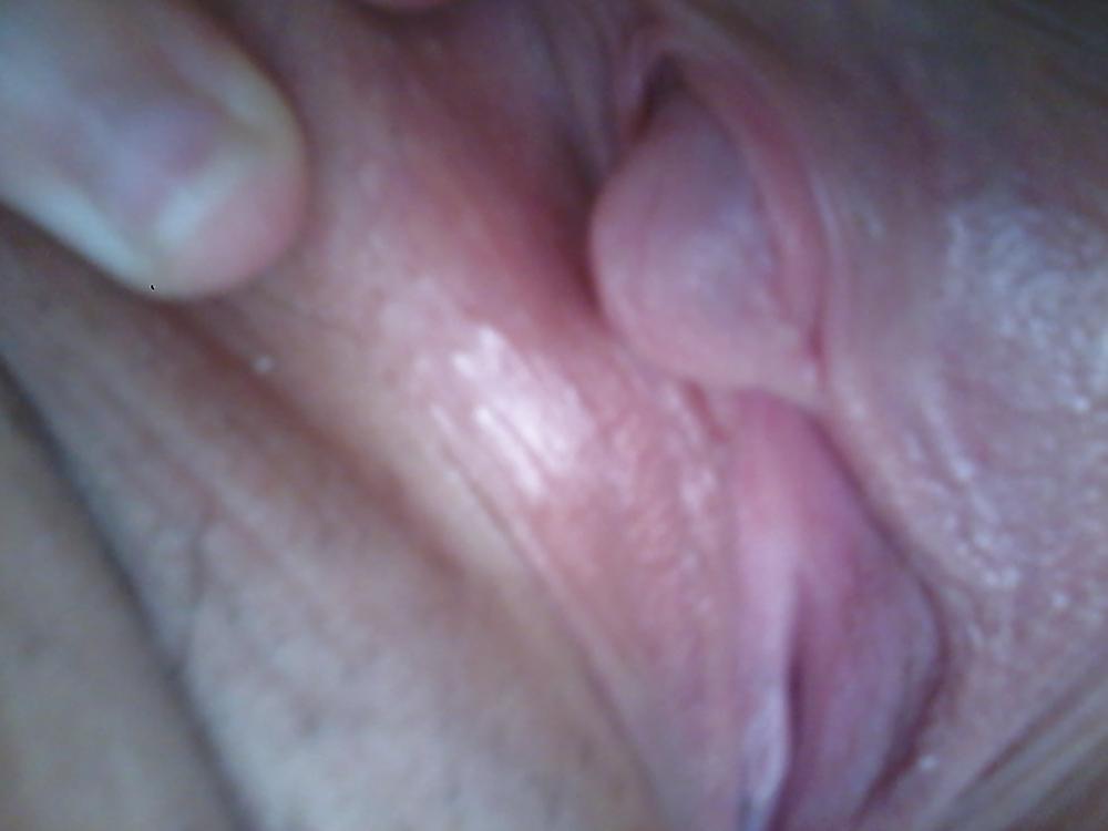 25P My Clit