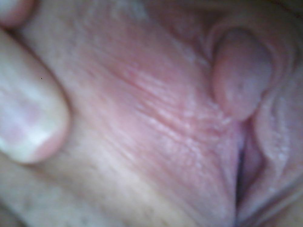 25P My Clit