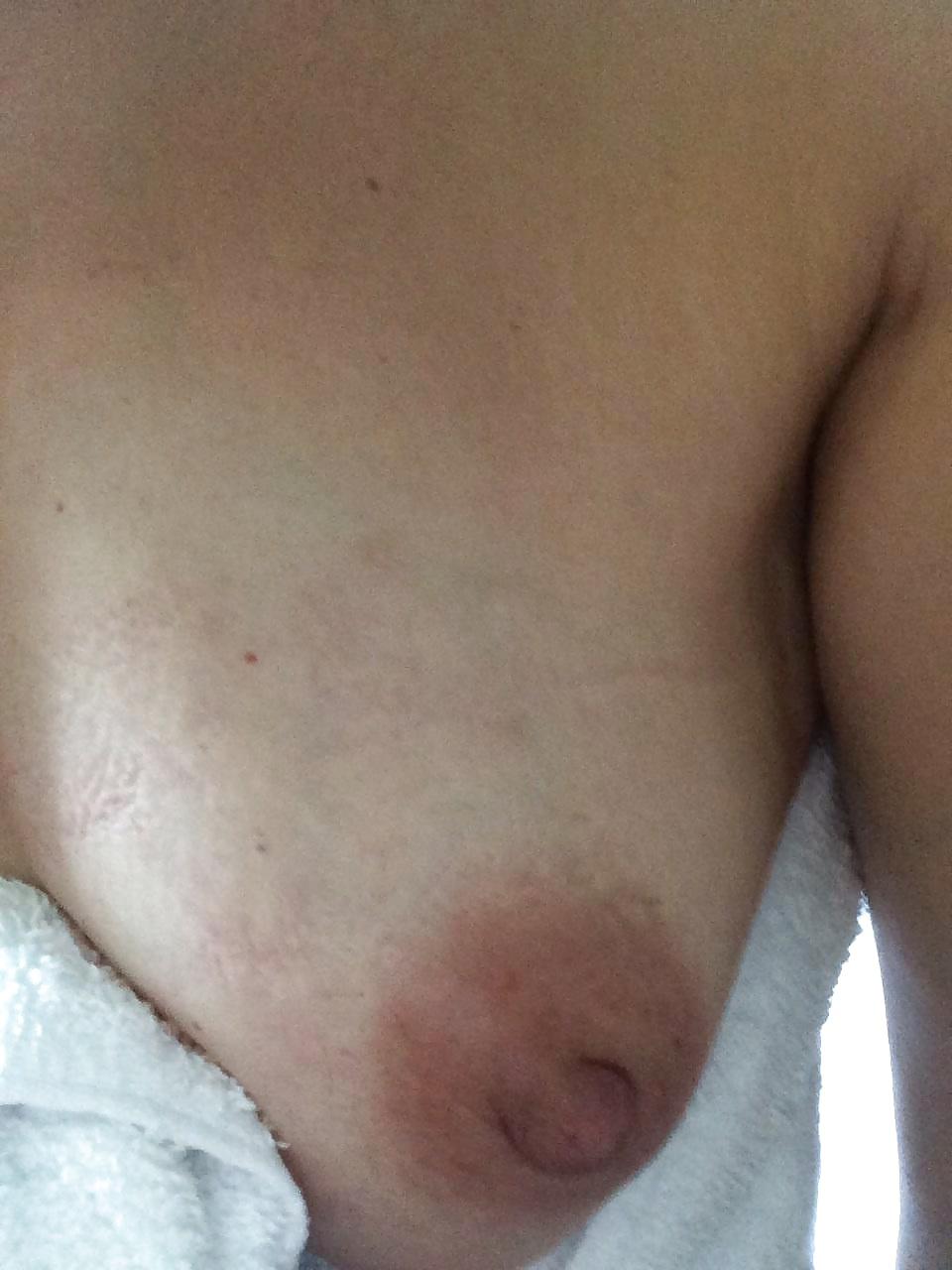 4P Nipples 