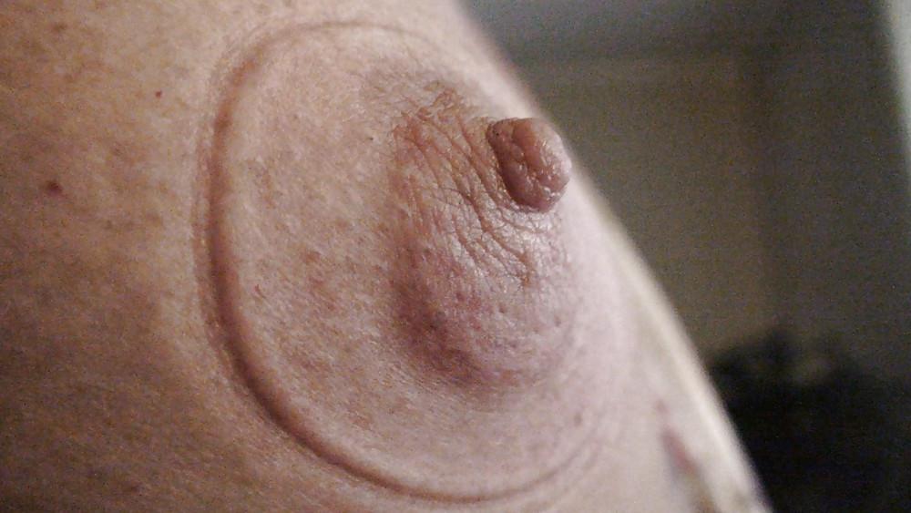 25P Nipples