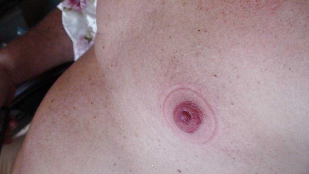 25P Nipples