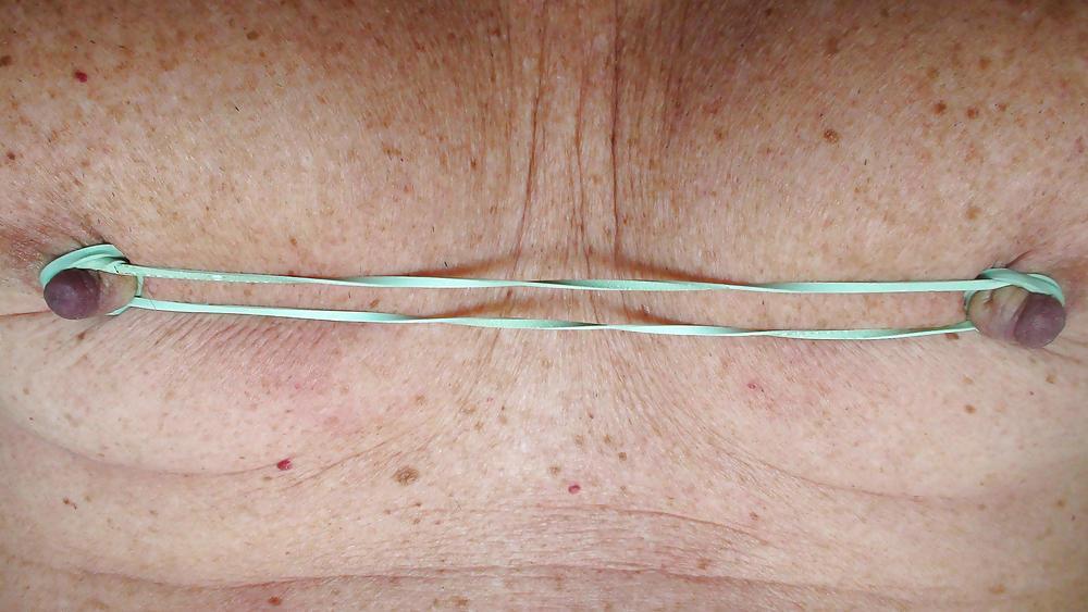 25P Nipples