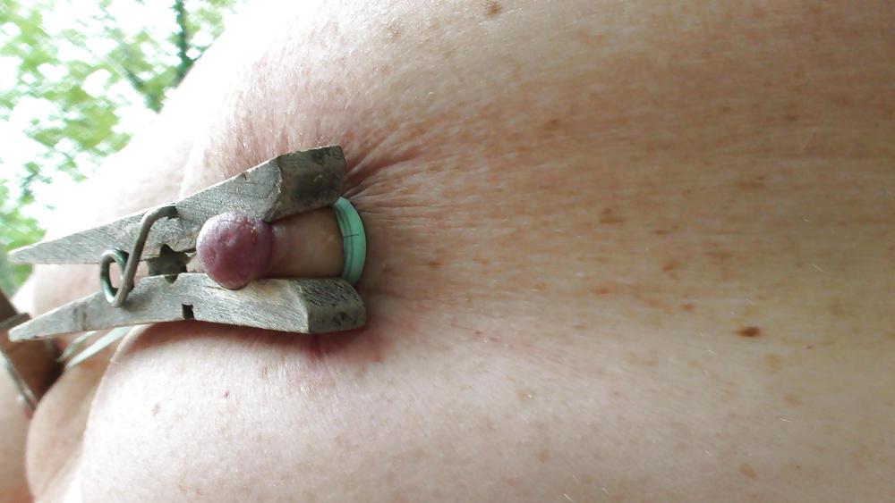25P Nipples