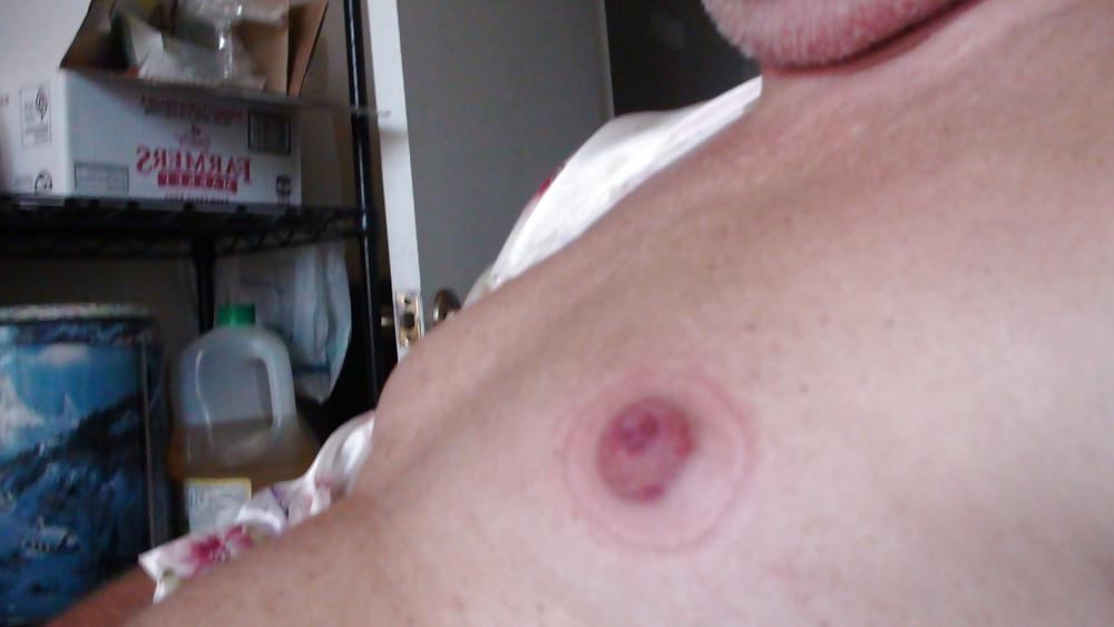 25P Nipples
