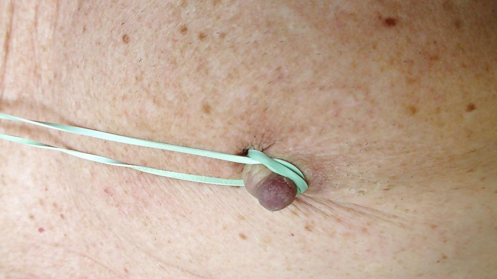 25P Nipples
