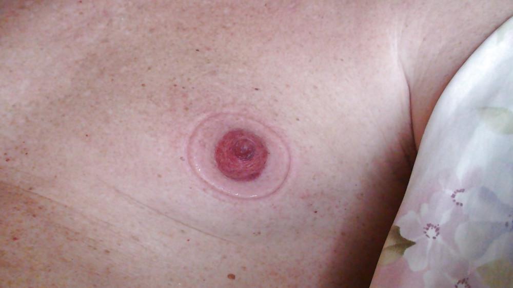 25P Nipples