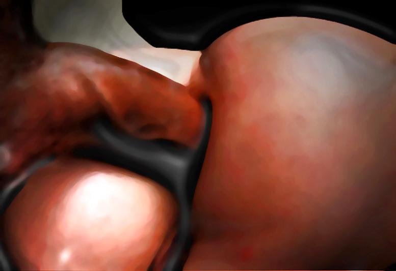 19P Study of butt