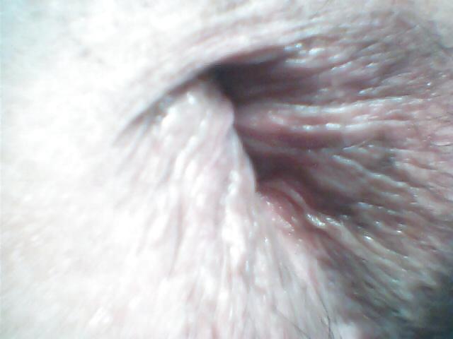 8P Close up