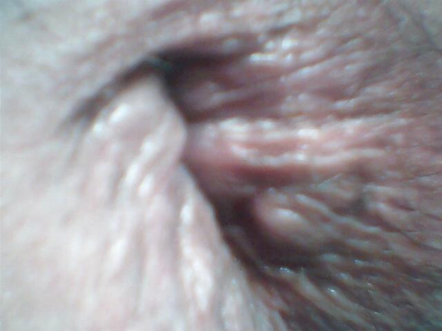 8P Close up