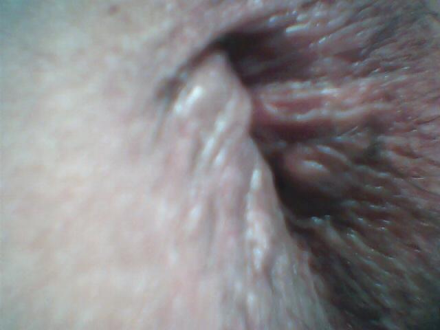 8P Close up