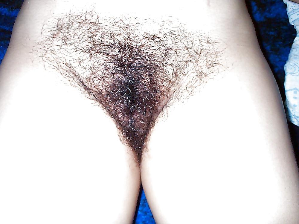 20P Hairy Close Up