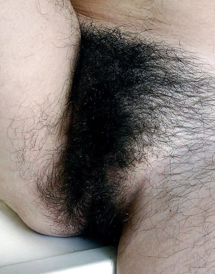 20P Hairy Close Up