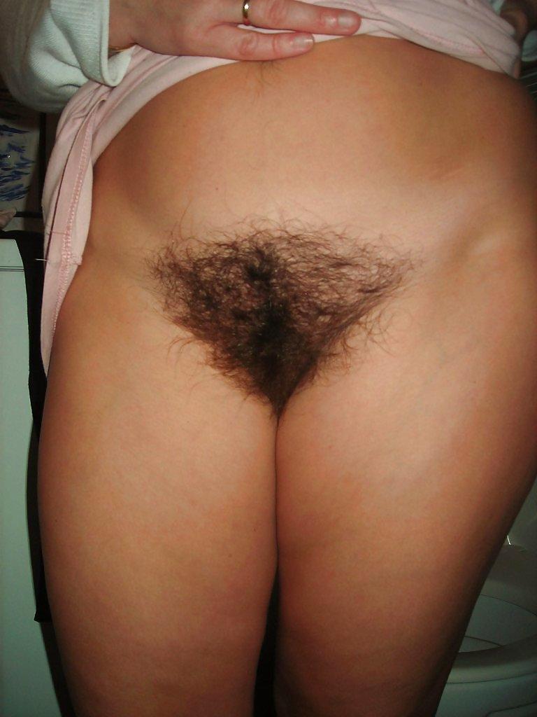 20P Hairy Close Up