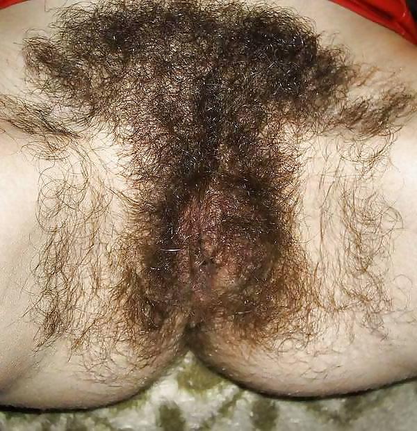 20P Hairy Close Up