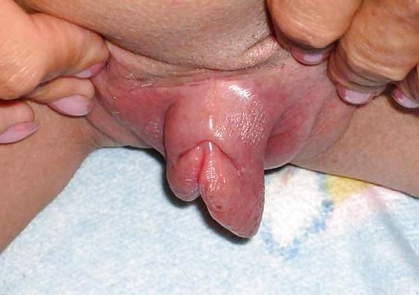 10P Meaty clit