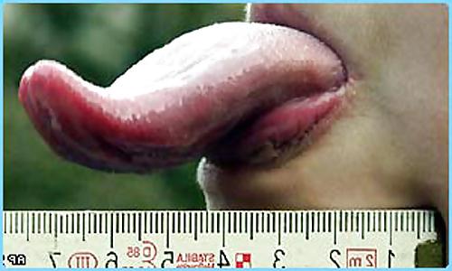 25P Mature & Teen
