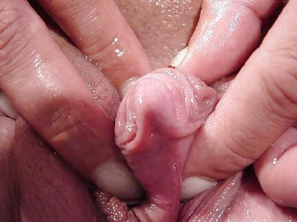 15P Close-up