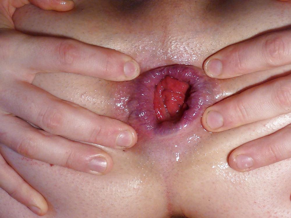 6P Butt plug