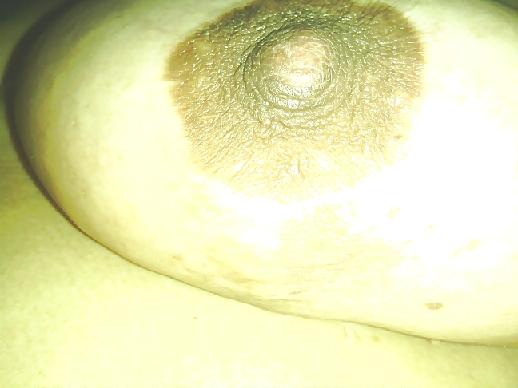 25P Nipples