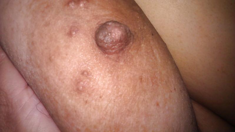 25P Nipples
