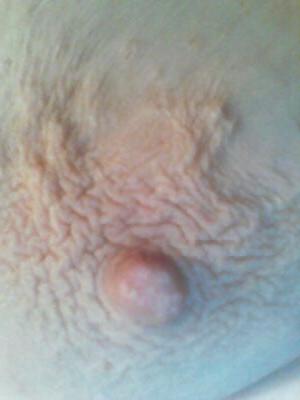 25P Nipples