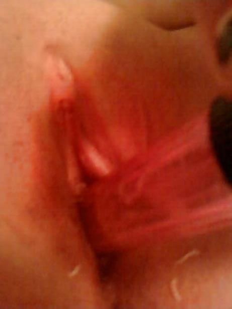 20P Hot Chubby teen girl