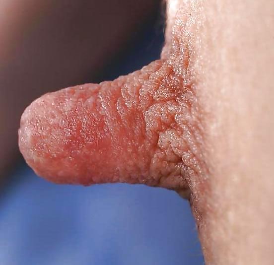 25P Hard Nipples