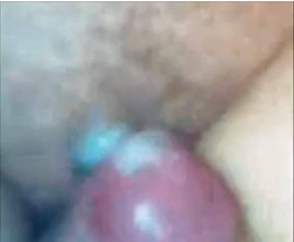 15P Close Up and Personal With Milf Mary's Tits and Hairy Pussy