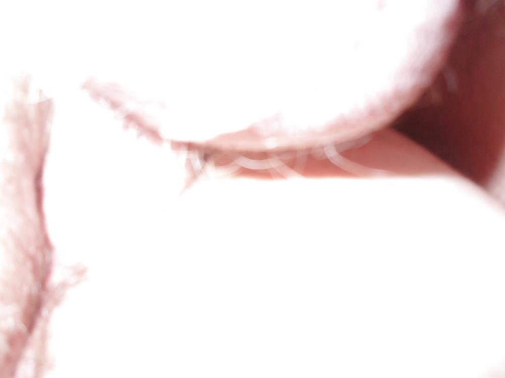 5P Gf anal