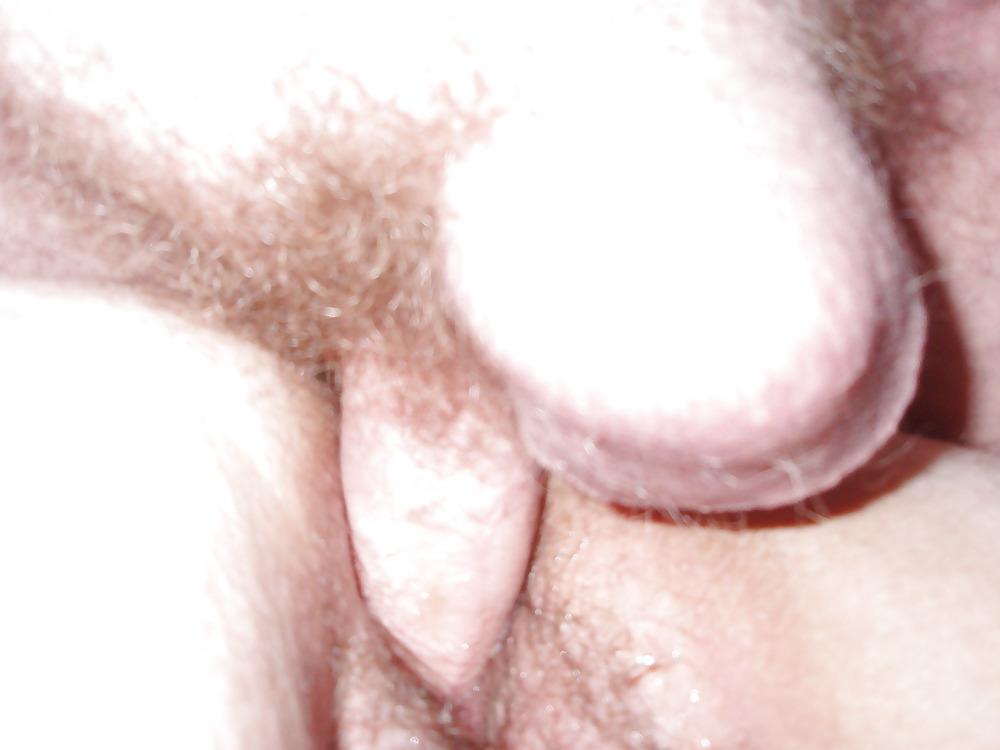 5P Gf anal