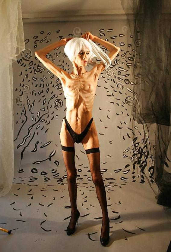 12P Anorexic girls ... is that really sexy?