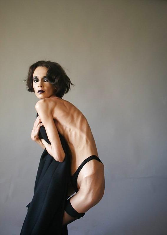 12P Anorexic girls ... is that really sexy?