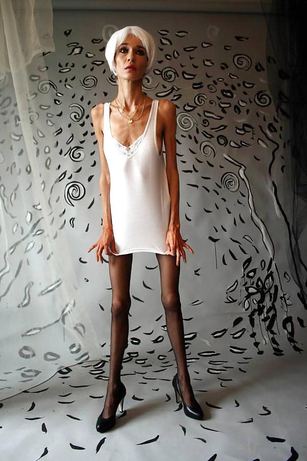 12P Anorexic girls ... is that really sexy?