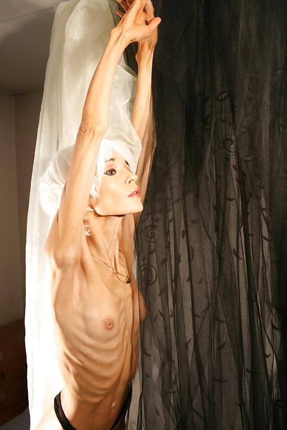 12P Anorexic girls ... is that really sexy?