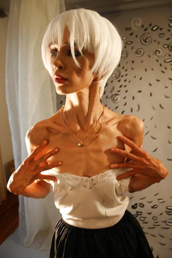 12P Anorexic girls ... is that really sexy?