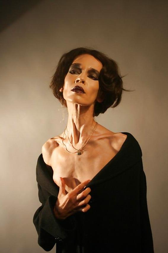 12P Anorexic girls ... is that really sexy?