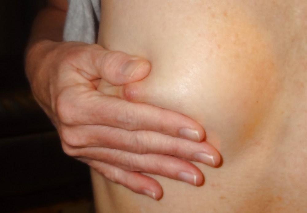 10P Mature body nipples