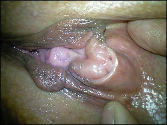 7P Is my clit swollen????