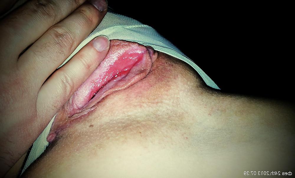11P Vagina 
