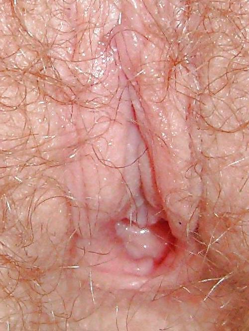 25P Pussy and Clit 7