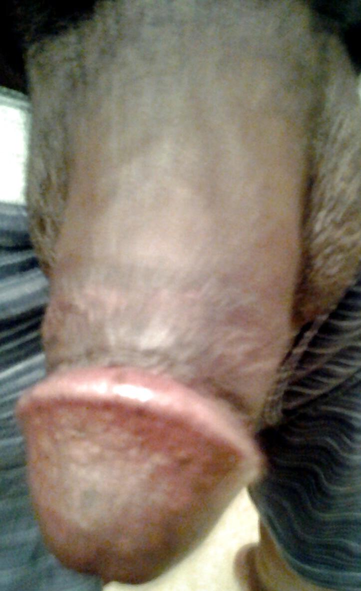 14P Bald black cat